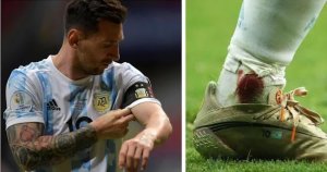 کاپیتان از جان گذشته آرژانتین؛ رد خون روی پای مسی