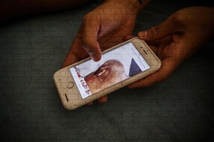 ماجرای تکان دهنده مصدومیت سانتی کازورلا