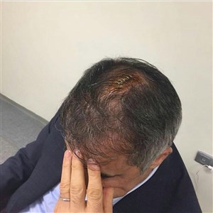 لحظه شکسته شدن سر سنول گونش در دربی استانبول