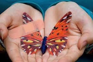 دیدار دوستانه به نفع کودکان پروانهای