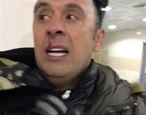 ضرب و شتم شدید مهدی پاشازاده در بوکان